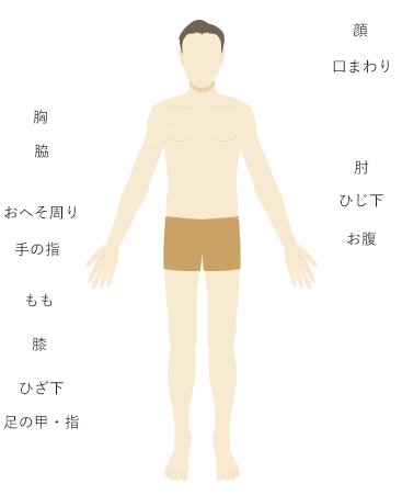 男性脱毛パーツ