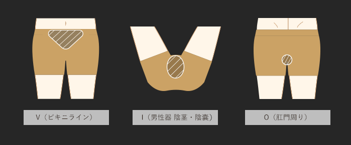 男性脱毛パーツ