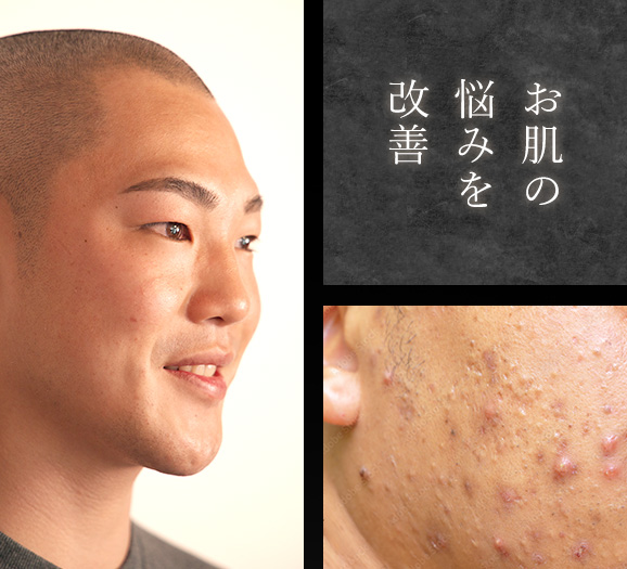 お肌の悩みを改善